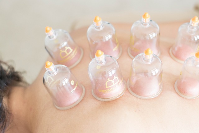 Foundations of Cupping
